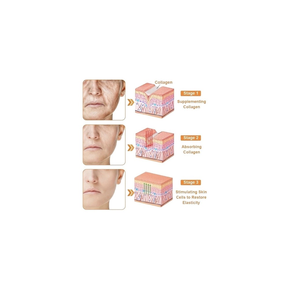 Bee Venom Skin Restoration Cream, Professional Bee Venom Skin Treatment Cream - Picture 7 of 9